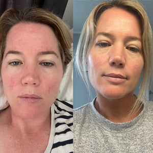 Inner Radiance | Skin Support Powder