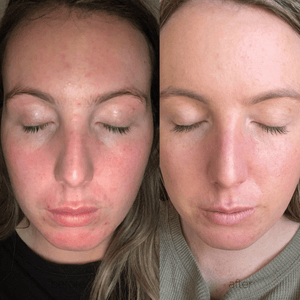 Double the Radiance - MAAEMO Organic